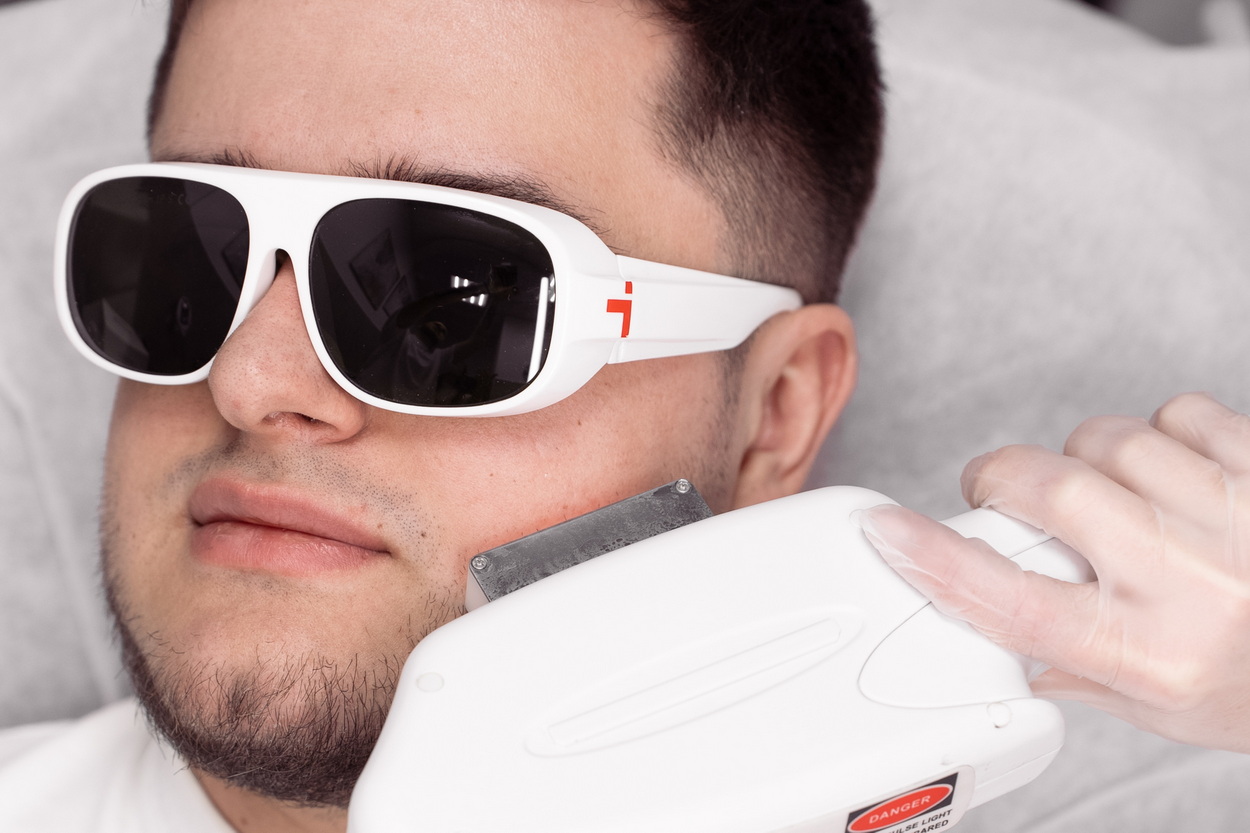 Лазерная эпиляция для мужчин