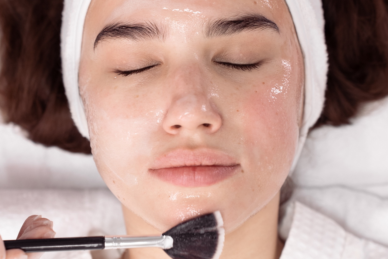 Гликолевый пилинг