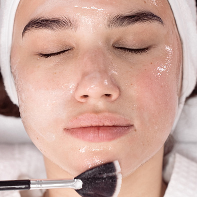 Гликолевый пилинг