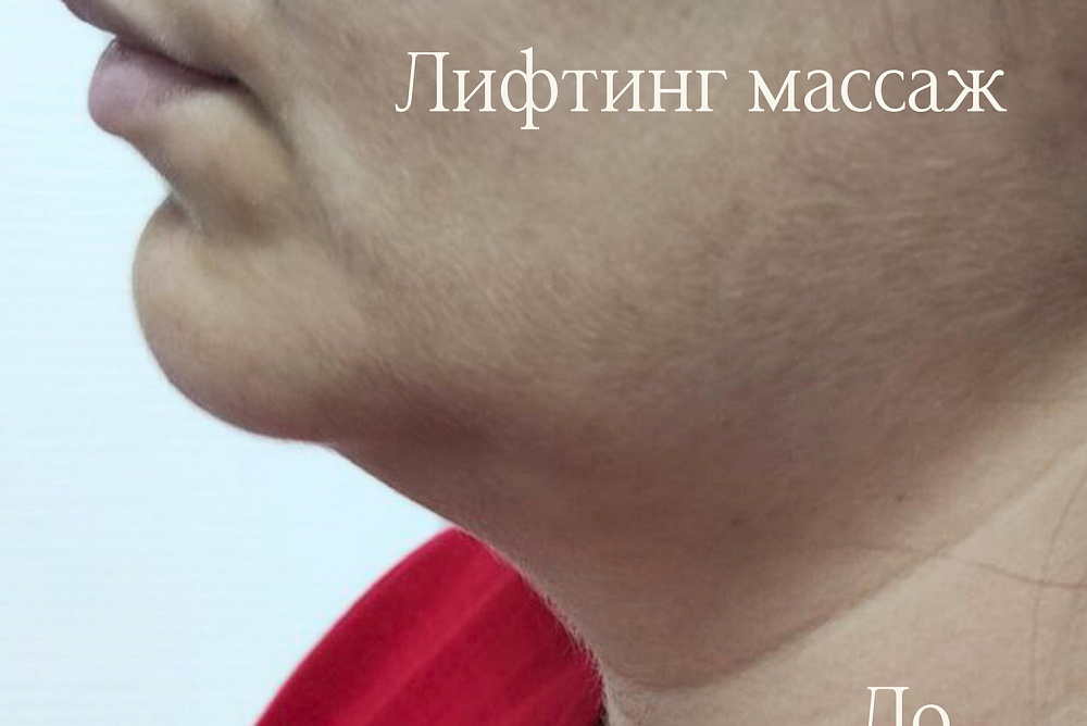 Лифтинг массаж