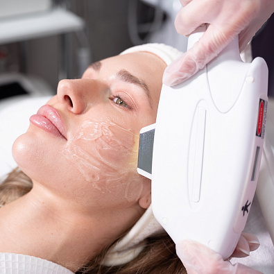 Фотоомоложение лица